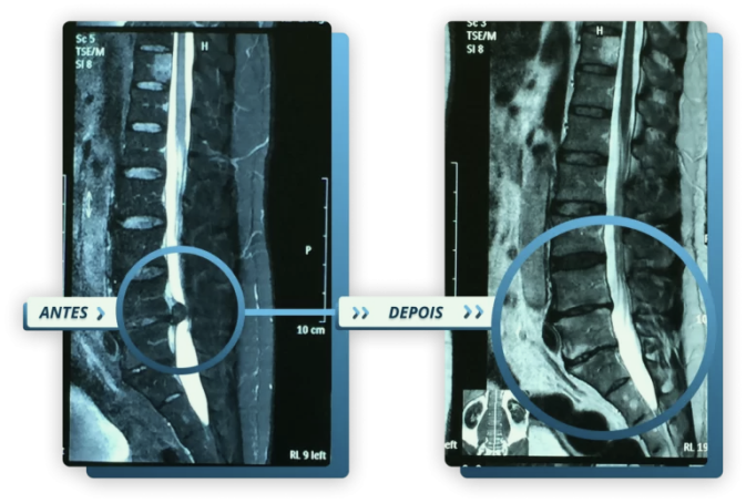 Profissional de fisioterapia CTEC